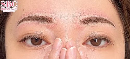 【女性・眉】アートメイク(眉毛)_after