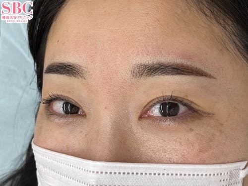 【女性・眉】mocci眉アートメイク（2Dパウダー）_aftar