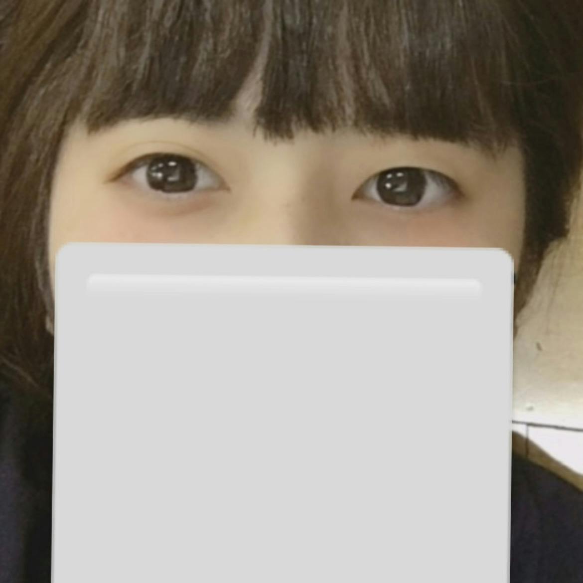 湘南美容クリニック 柏院で二重整形・二重埋没・奥二重整形・末広二重整形・平行二重整形・ミックス型二重整形・目元整形を受けたねこさんの写真