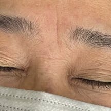 【女性・眉】アートメイク(眉毛)_before