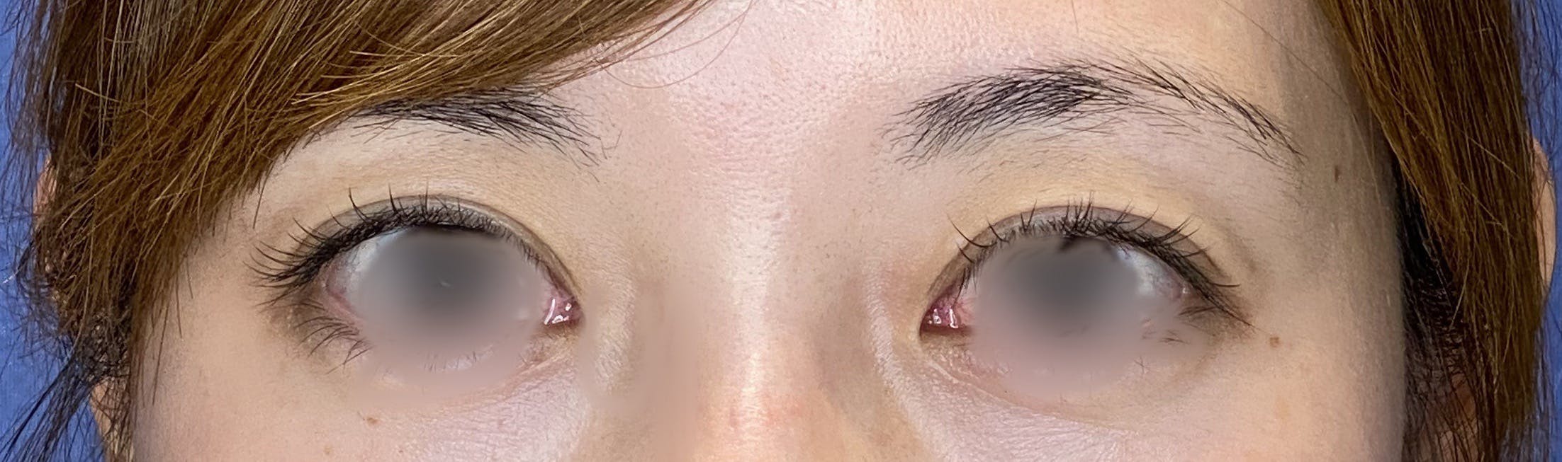 Vclinic 新宿院(ブイクリニック) / 旧:Venus Beauty Clinicでを受けたmmさんの写真