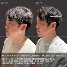 【男性・輪郭】FatX core_before_aftar