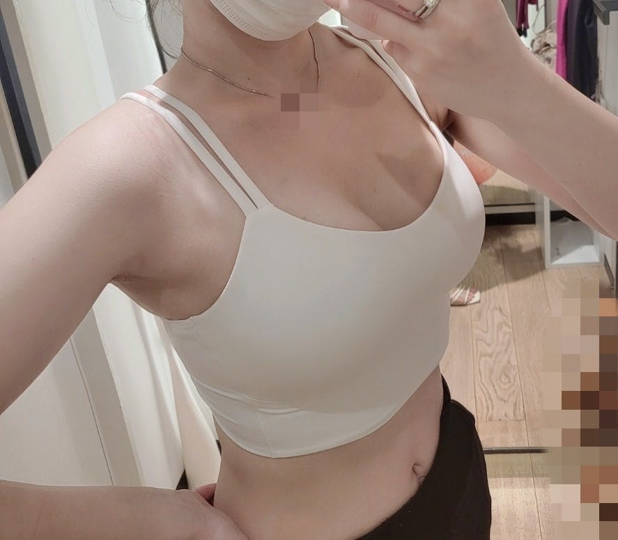 湘南美容クリニック 新宿本院でを受けたhanaさんの写真