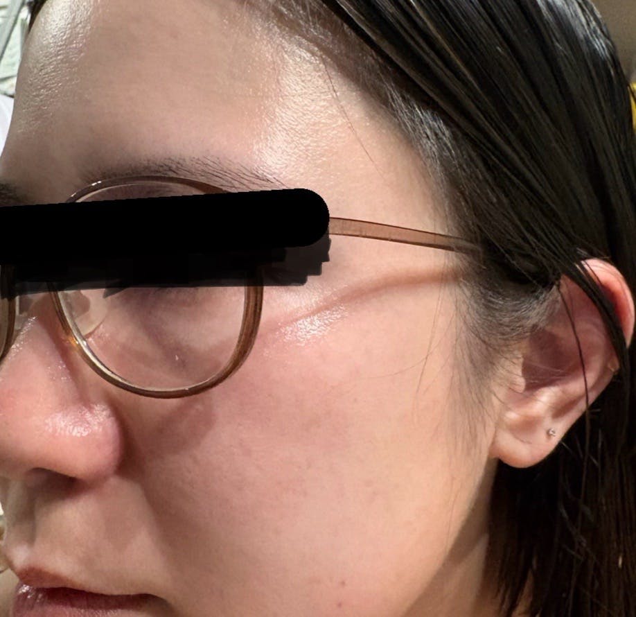 よつば会クリニック 神戸・ハーバーランド院でを受けたまゆさんの写真