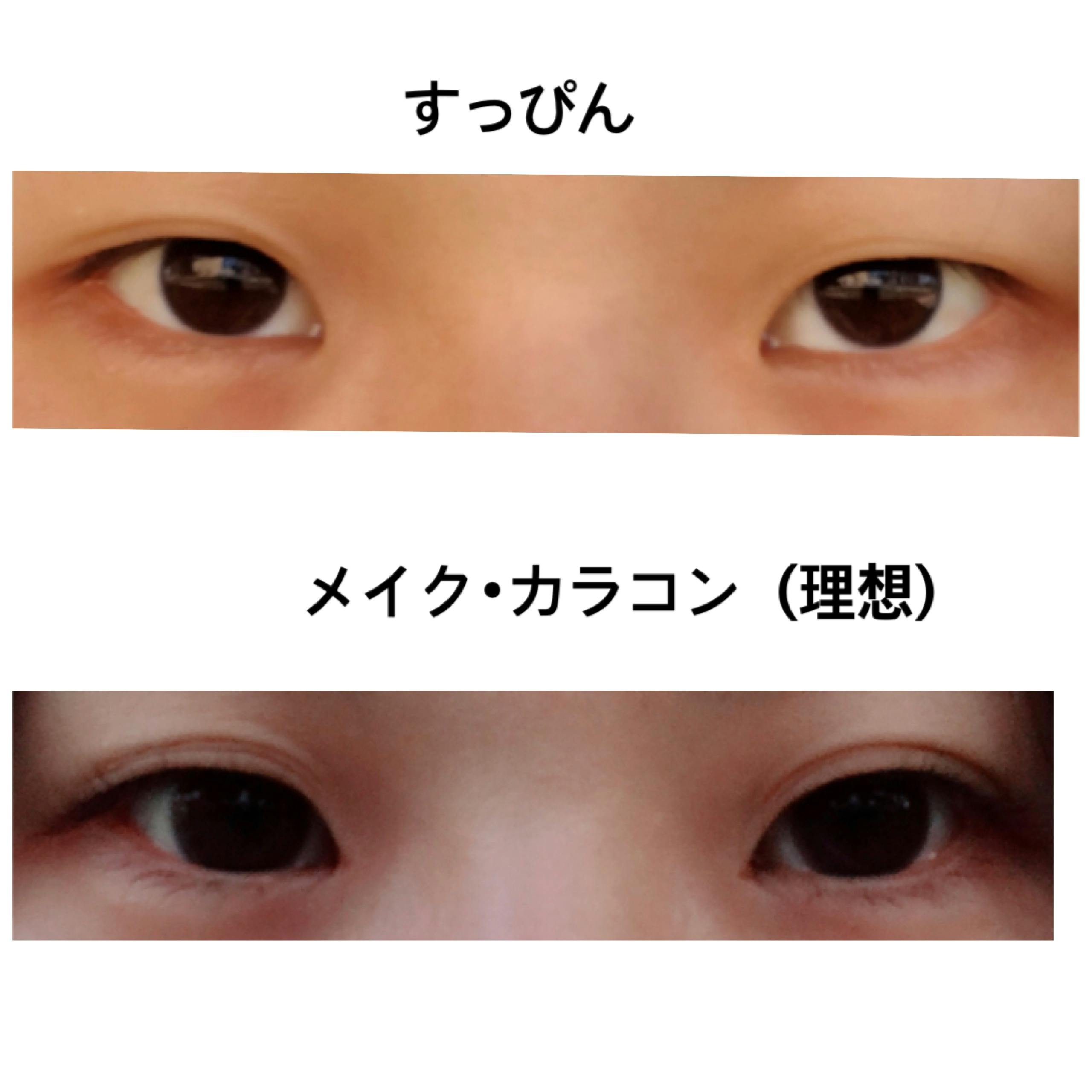 共立美容外科 名古屋院でを受けたじじさんの写真