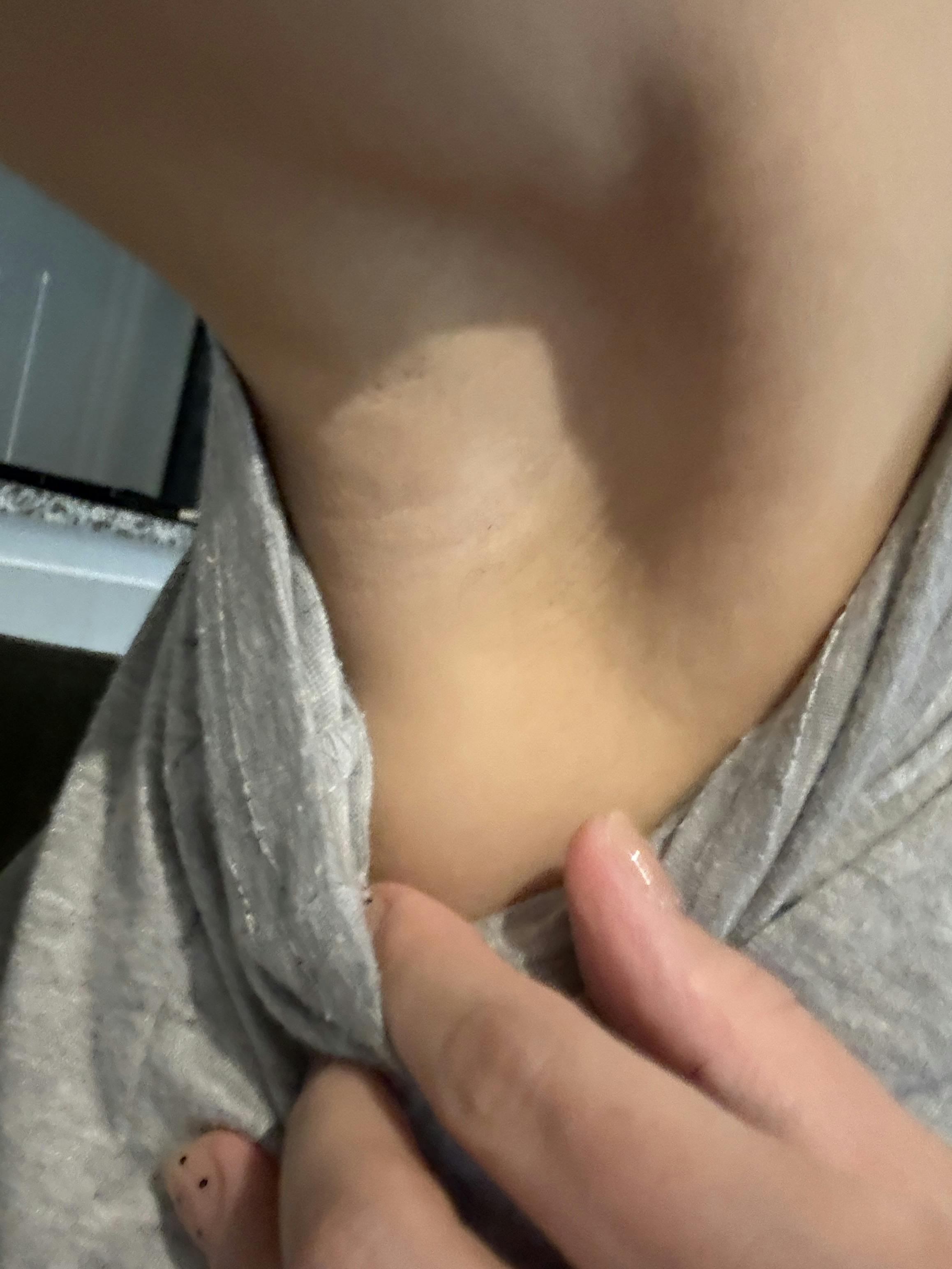 モーブビューティークリニック札幌大通(Mauve Beauty Clinic 札幌大通)で医療脱毛(胸)・医療脱毛(ワキ)・医療脱毛(腹)・医療脱毛(肘下)・医療脱毛(もみあげ・頬)・医療脱毛(額)・医療脱毛(Vライン)・医療脱毛(Iライン)・医療脱毛(Oライン)・医療脱毛(肘上)を受けたelleriさんの写真