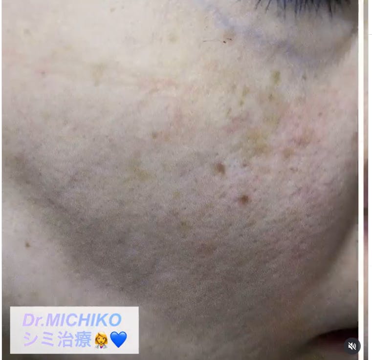 フェミークリニック 池袋院_before