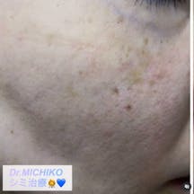 フェミークリニック 池袋院_before