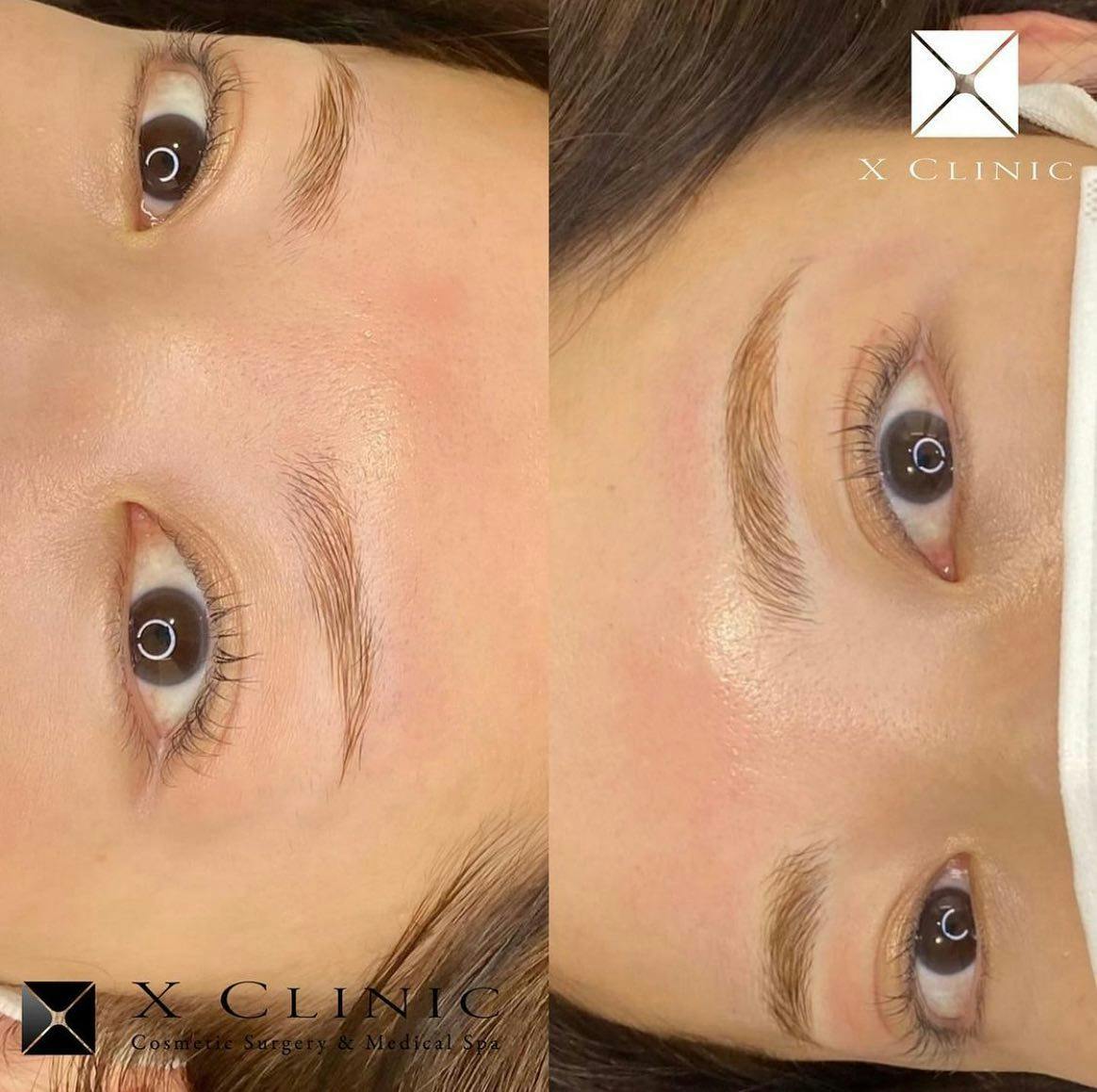 【女性・眉】アートメイク_BROWS 眉_before_aftar