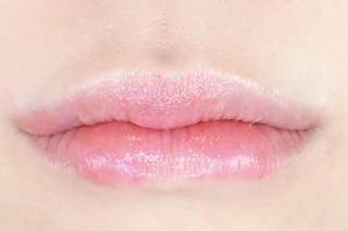 ルラ美容クリニック 広島院でCカールリップを受けたてぃさんの写真