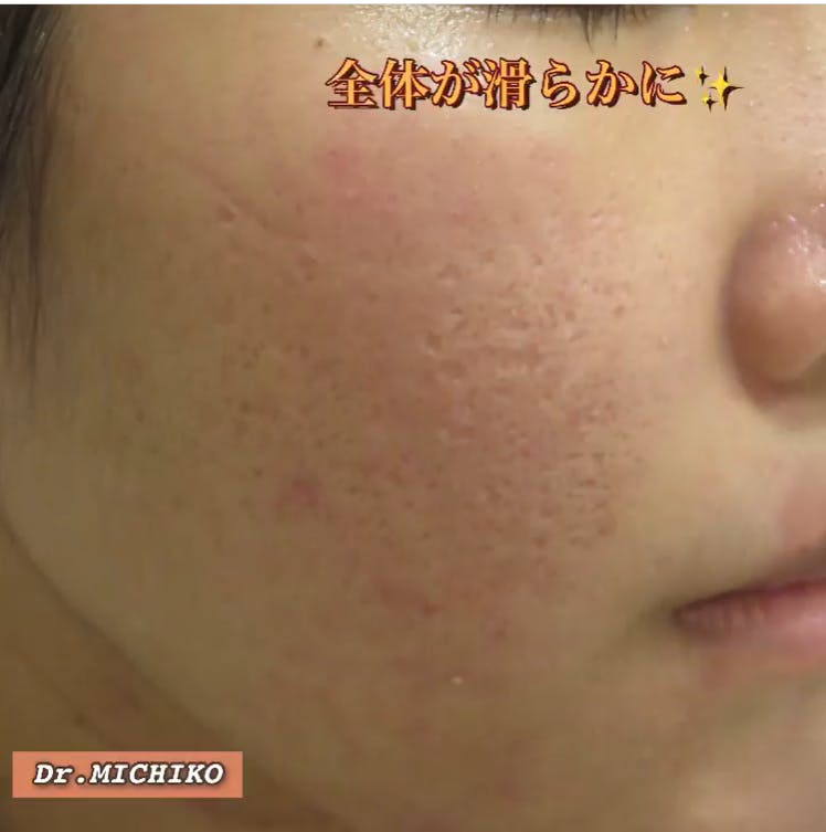 フェミークリニック 池袋院_after