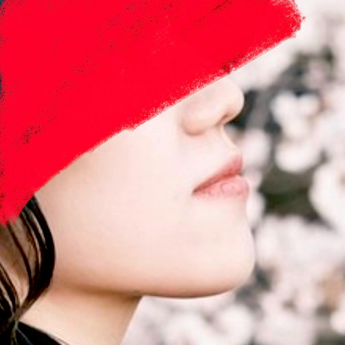 湘南美容クリニック 品川院で目の下のクマ・たるみ取り・ボトックス注射・顎のボトックス注射・目尻ボトックス注射・眉間ボトックス注射・目の下ボトックス注射・おでこ(額)ボトックス注射・バニーライン・鼻根ボトックス注射・韓国製ボトックス・ボツリヌストキシン・クマ取り注射・アラガン製ボトックスを受けたぬのなのさんの写真