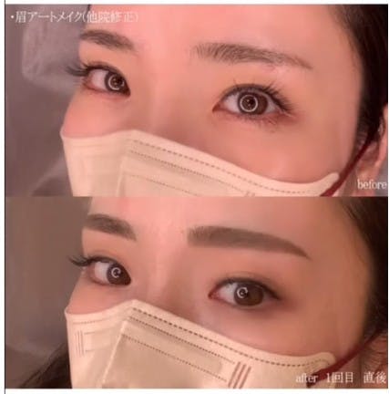【女性・眉】アートメイク_before_aftar