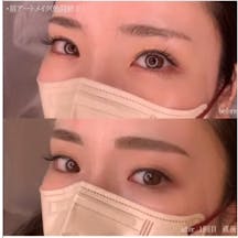 【女性・眉】アートメイク_before_aftar