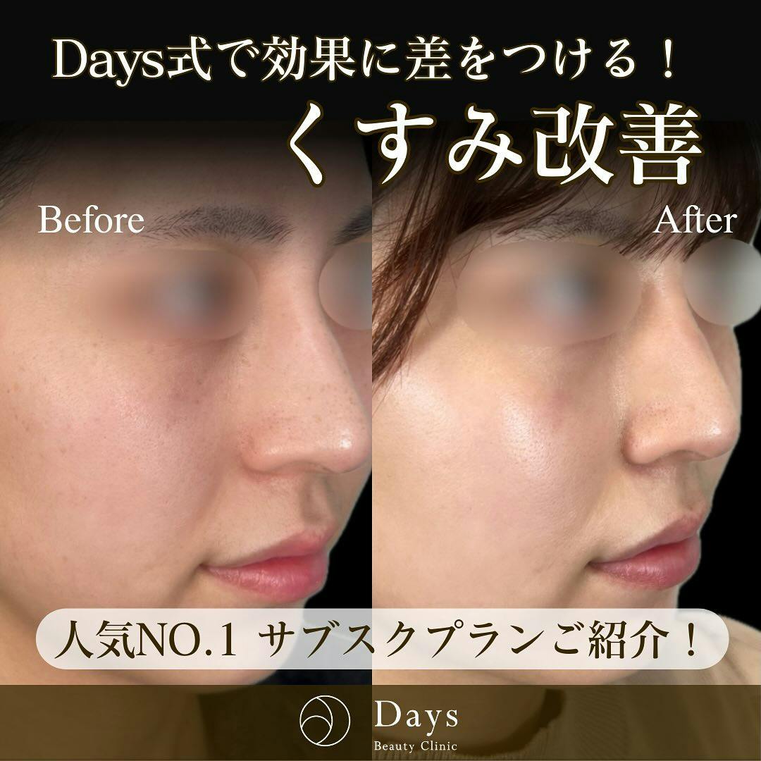 症例写真・ビフォーアフター画像No.6709 | デイズビューティー