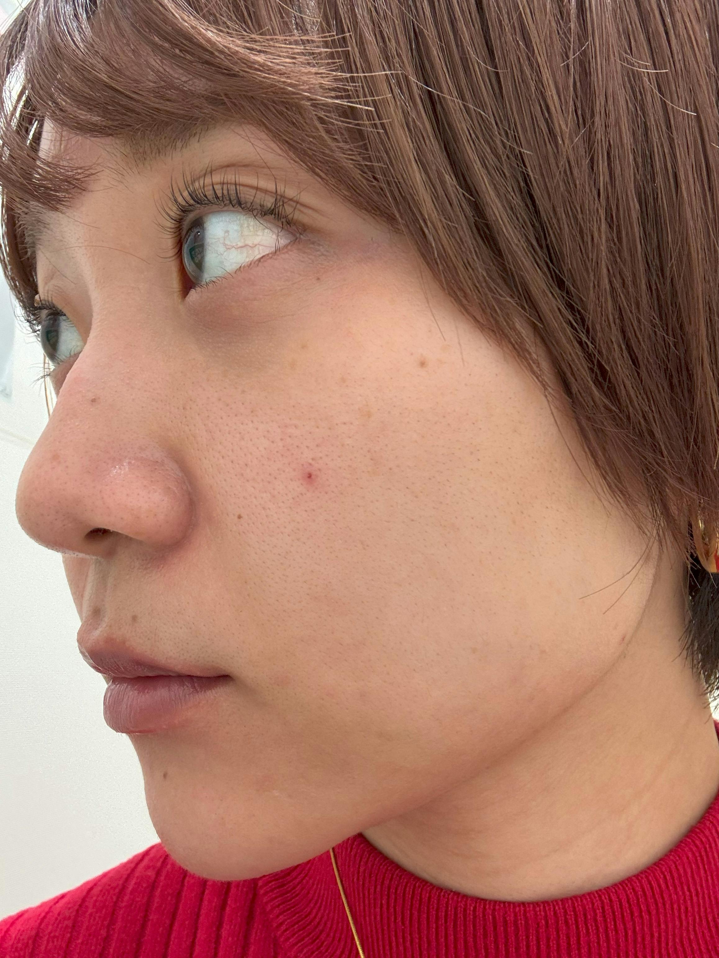 天王寺フェミークリニック(旧 リナクリニック 天王寺院)でを受けたリンノスケさんの写真