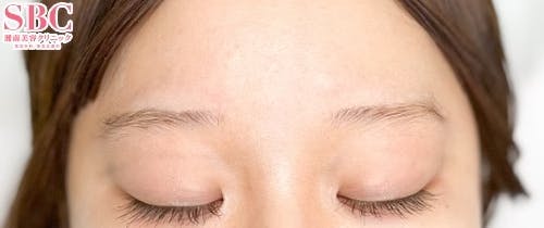 【女性・眉】アートメイク(眉毛)_before