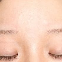 【女性・眉】アートメイク(眉毛)_before