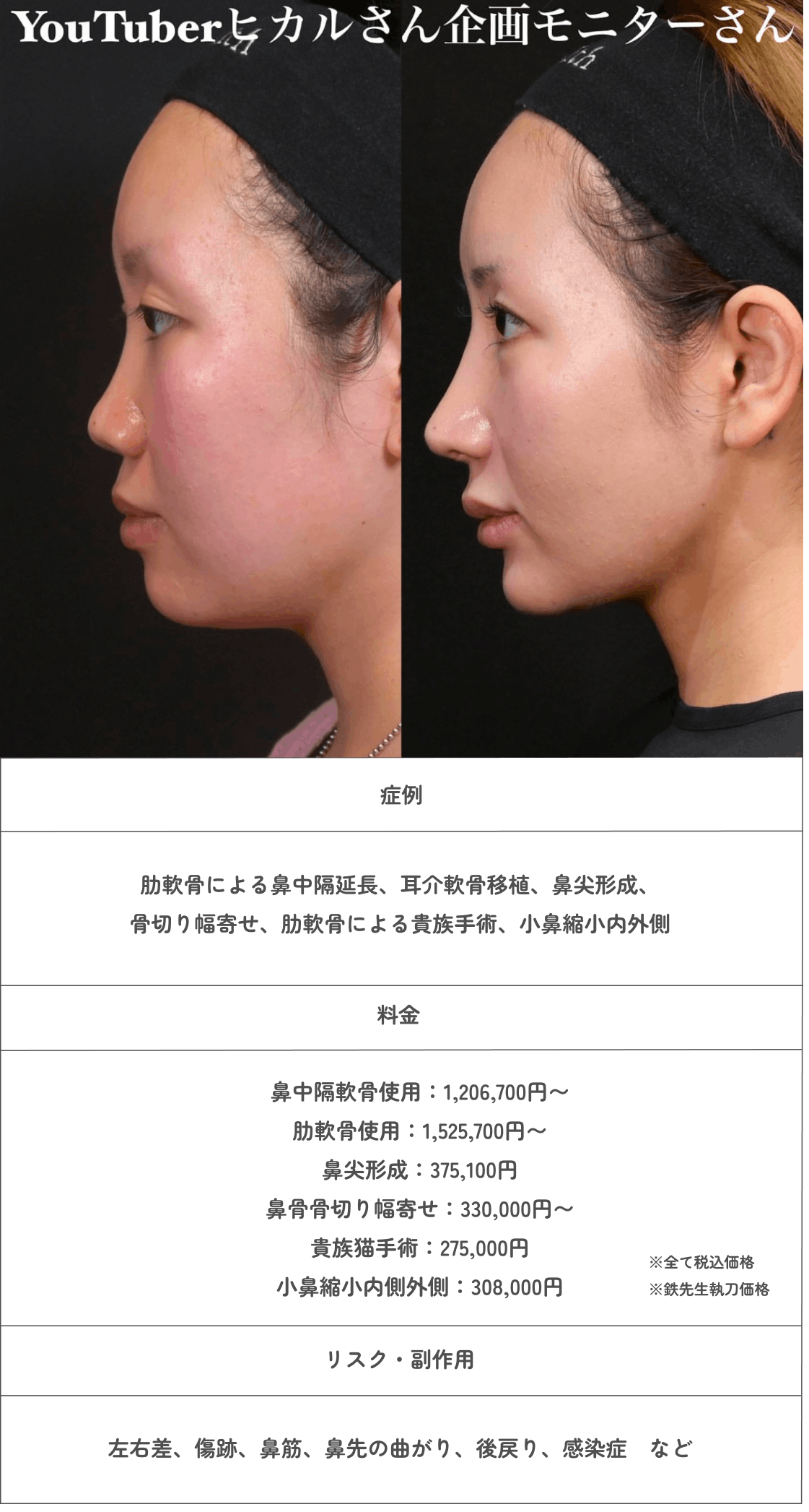 全体のバランスを見て似合う鼻を提案。鼻整形の名医に聞く、理想