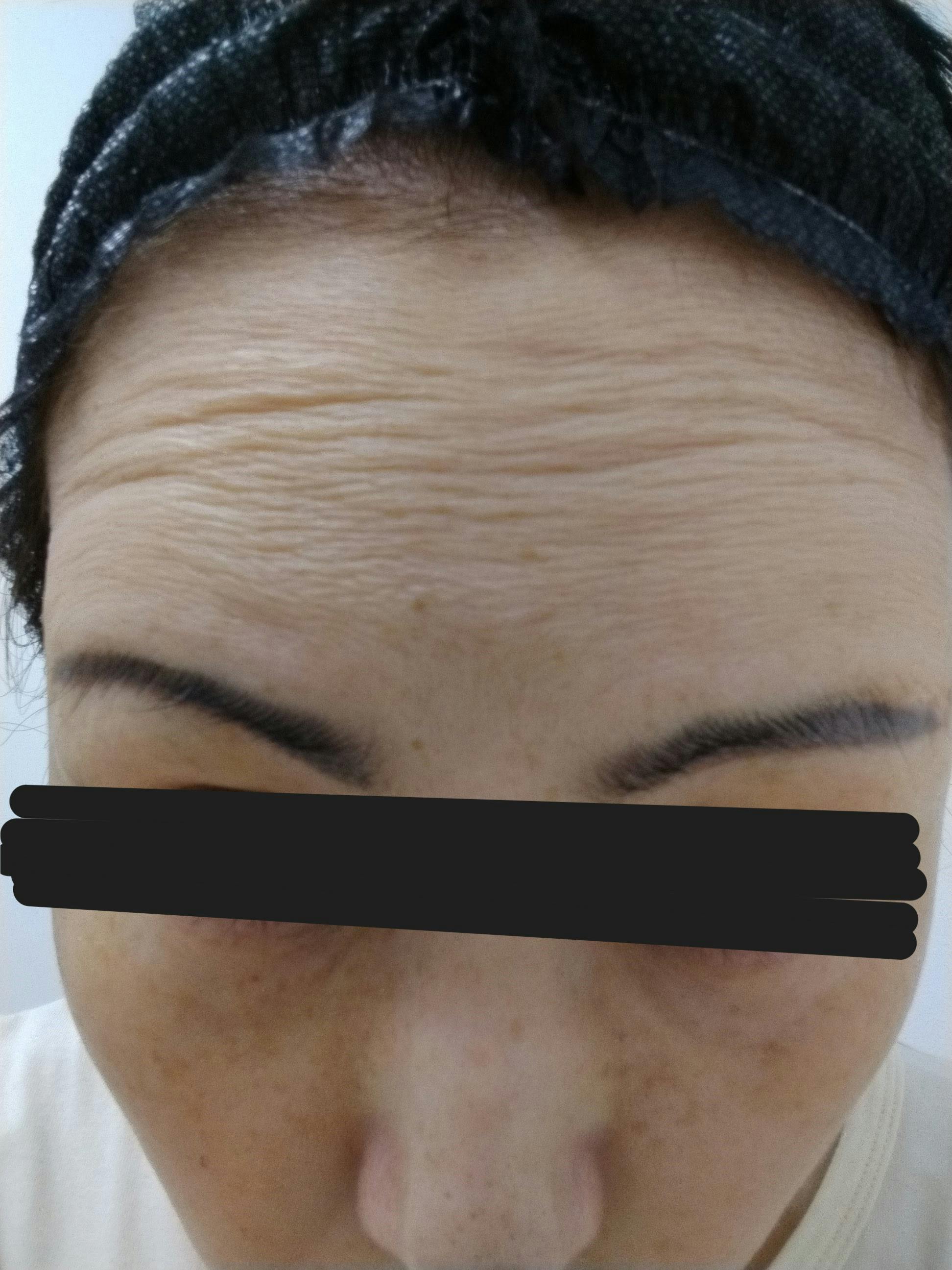 湘南皮膚科クリニック 町田院でを受けたジャスミンさんの写真