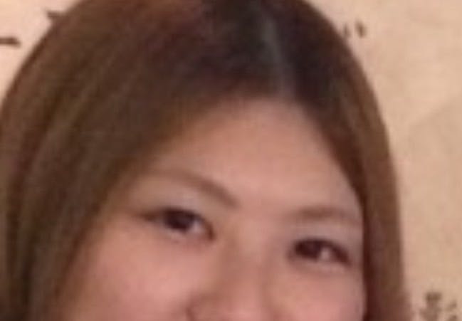 品川美容外科渋谷院(※品川スキンクリニック提携)で二重整形・二重埋没を受けたマリアさんの写真