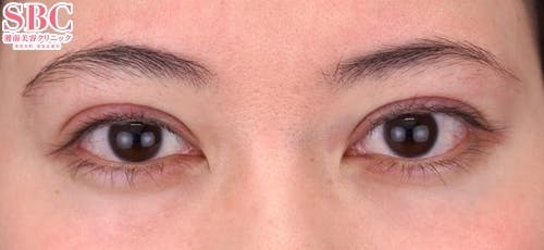 【30代女性・目元】クイックコスメティーク・トリプルNeo_0day