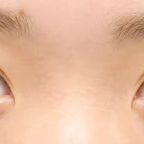 【女性・目元】クイックコスメティーク・トリプルNeo_after