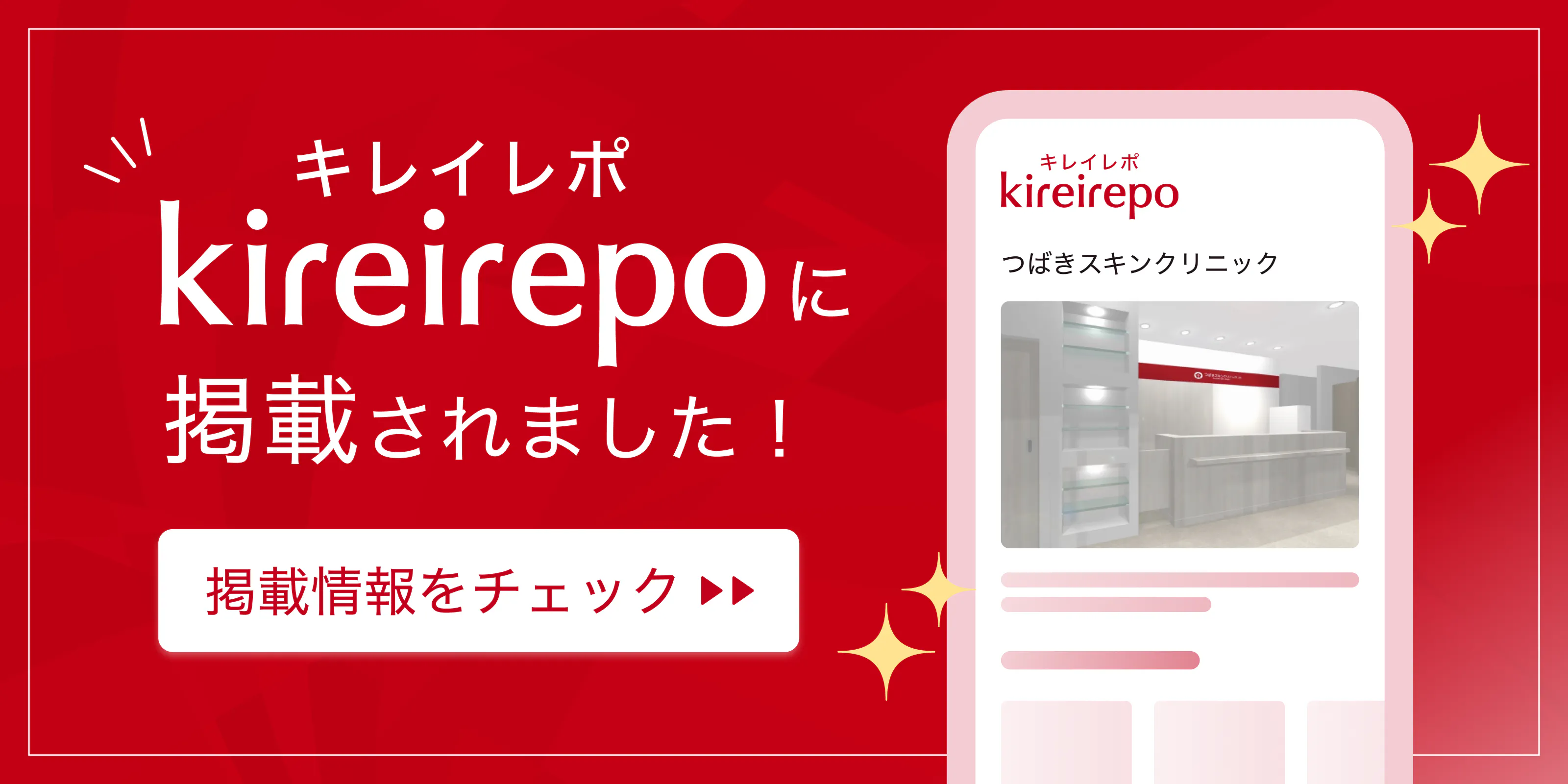 美容医療(自由診療・審美歯科)のプラットフォーム「キレイレポ」につばきスキンクリニックが掲載されました。