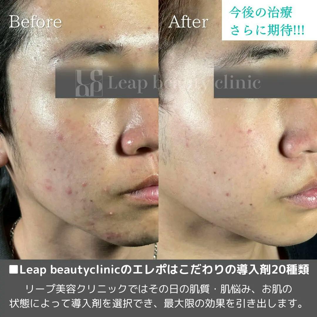 宇都宮市】エレクトロポレーションができるおすすめ美容クリニックTOP20