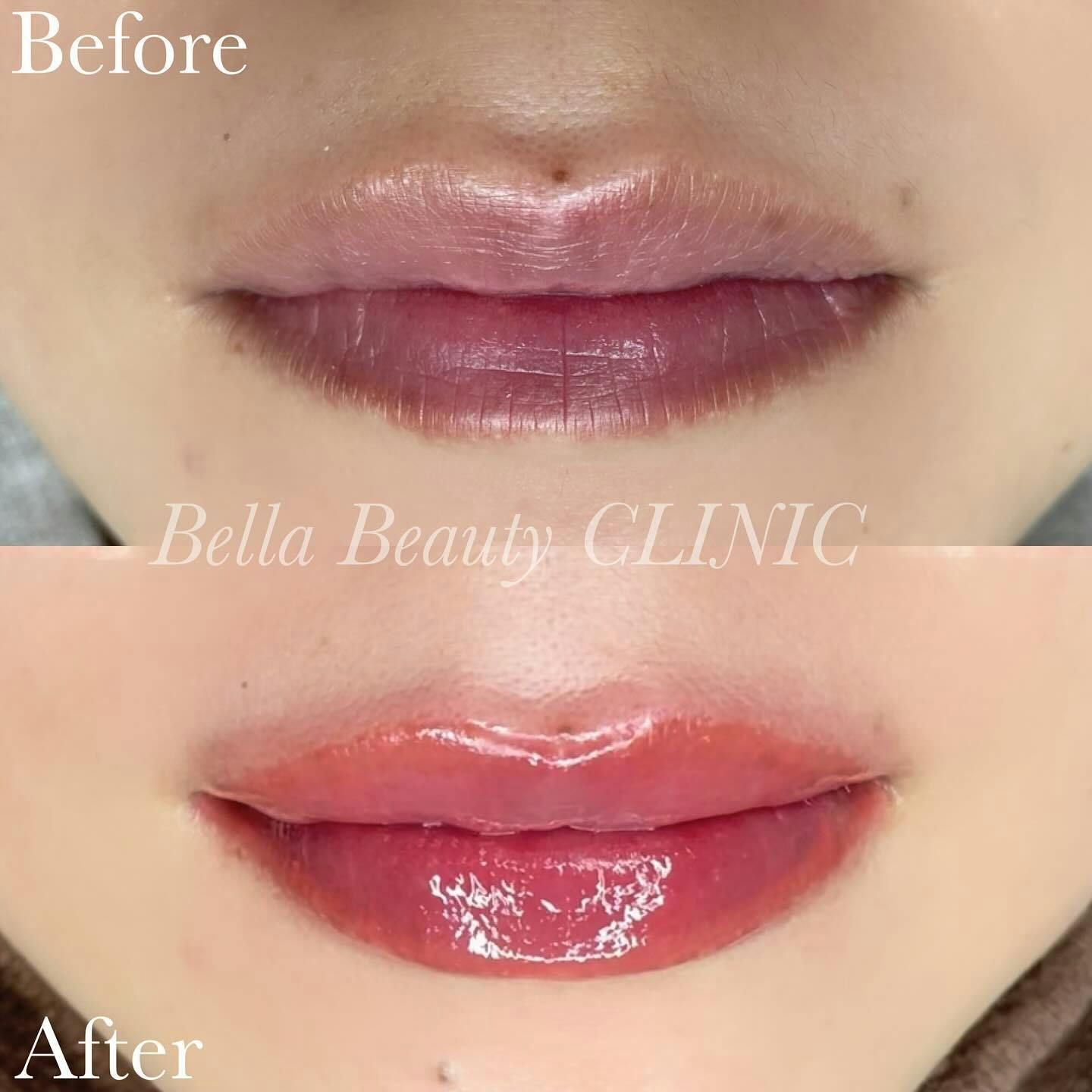 【女性・唇】リップアートメイク_before_aftar