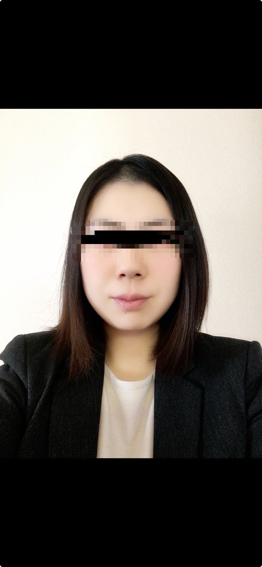 湘南美容クリニック 千葉センシティ院でハイフ(HIFU)・ウルトラセル・ウルトラセルQ・リフトアップ・目元のHIFUを受けたマリアさんの写真