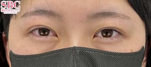 【20代女性・目元】クイックコスメティーク・ダブルNeo_justafter