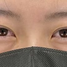 【20代女性・目元】クイックコスメティーク・ダブルNeo_justafter