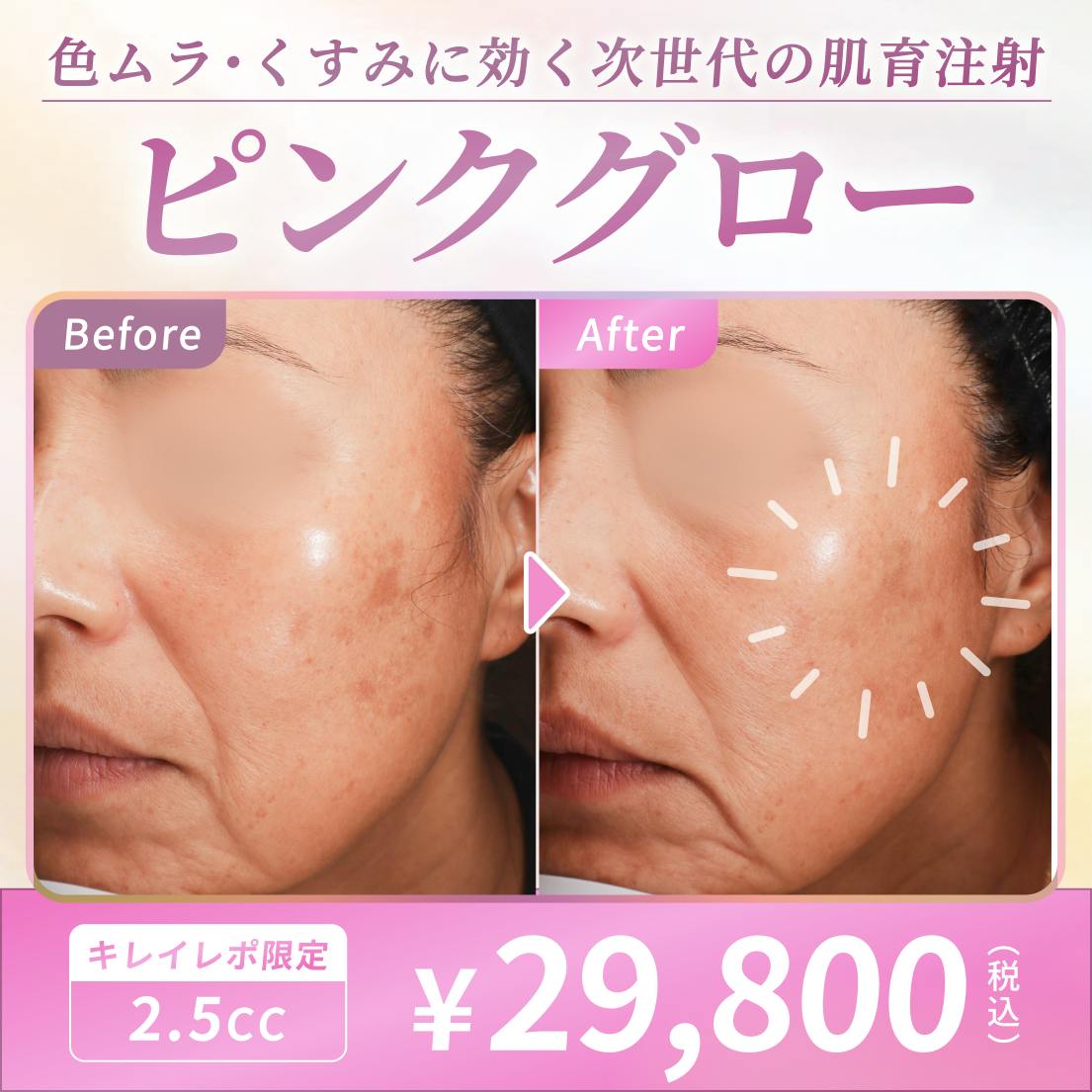 ピンクグローの画像