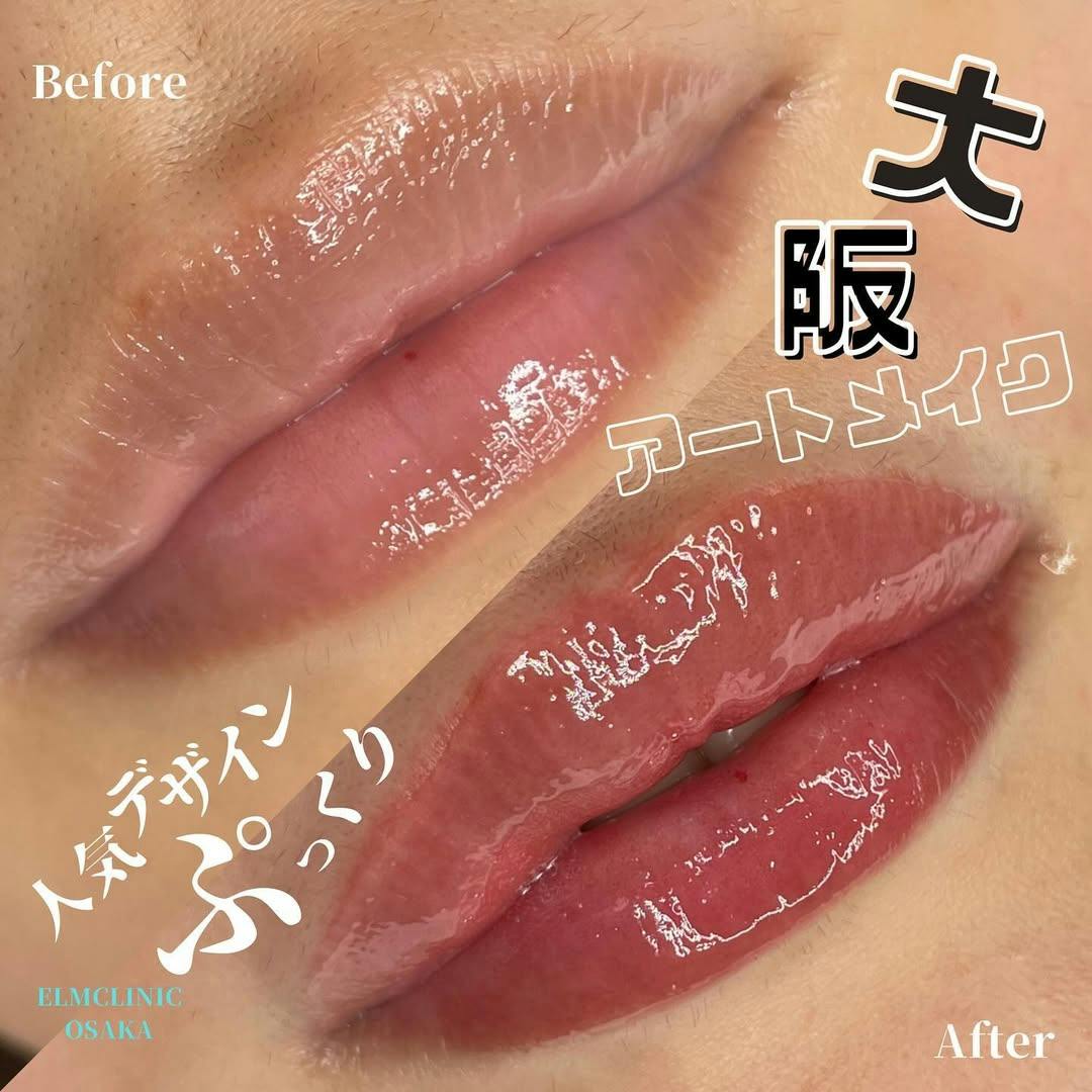 【女性・唇】アートメイクリップ_before_aftar