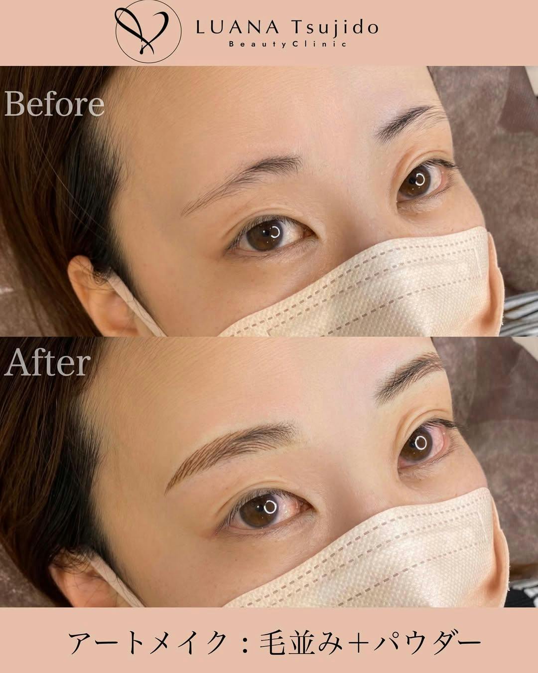 【女性・眉】眉アートメイク_before_aftar