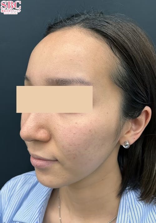 湘南美容クリニック 岐阜院_before